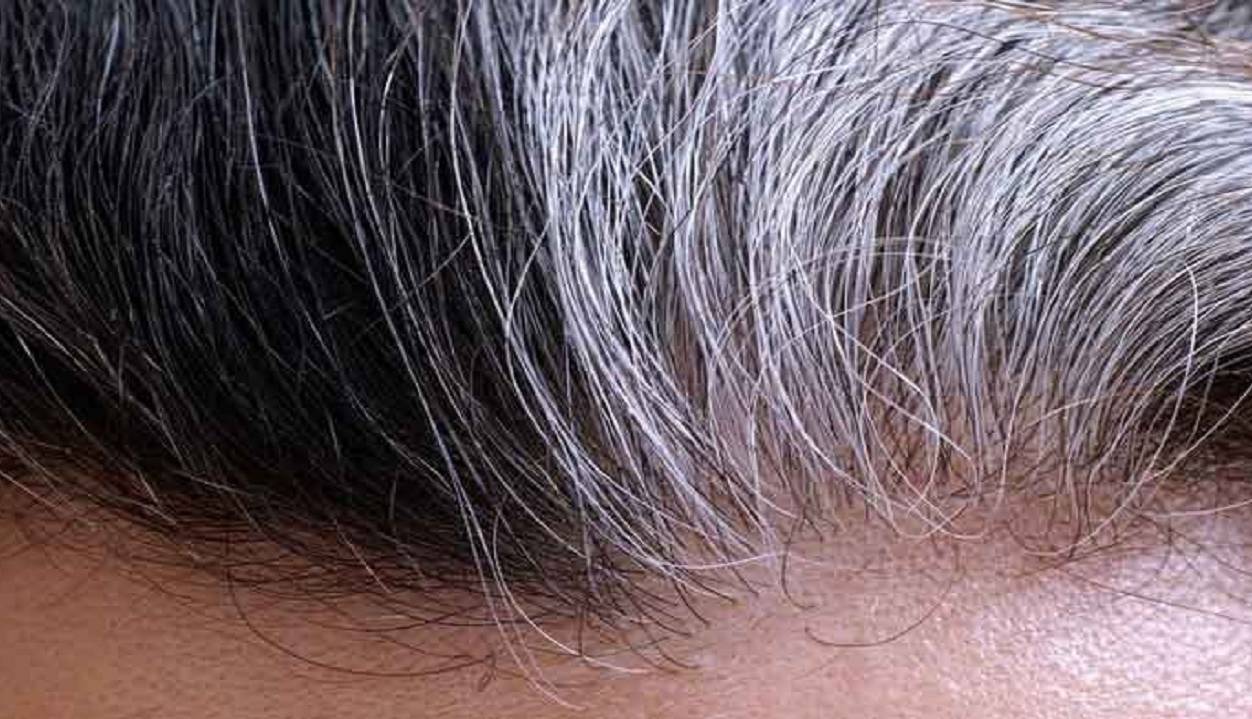 چرا موهایم سفید می شود؟