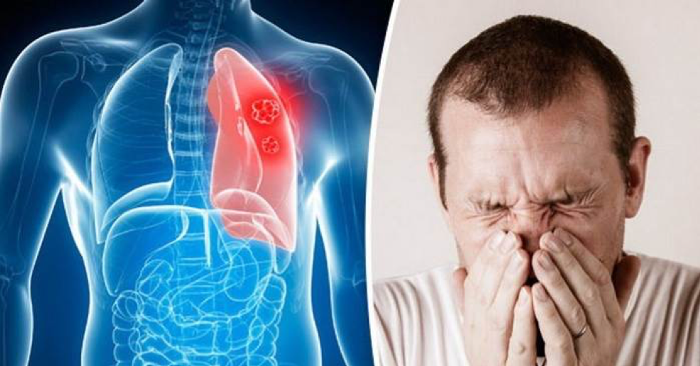 علت و درمان عفونت ریه در خانه و راه حل‌های آن