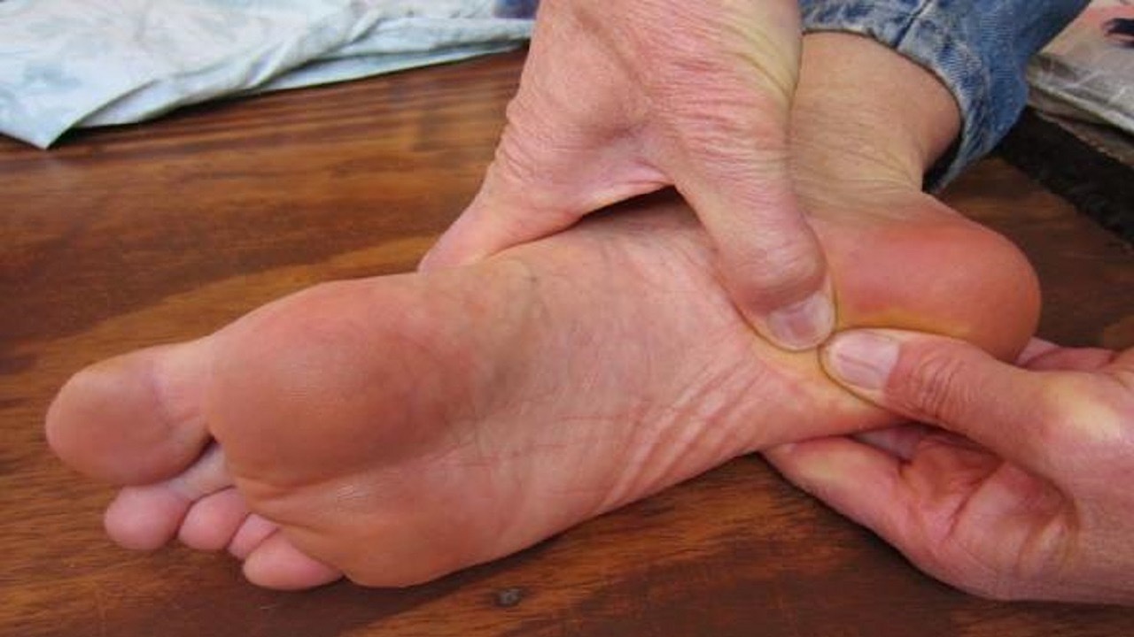 خار پاشنه چه علائمی دارد؟