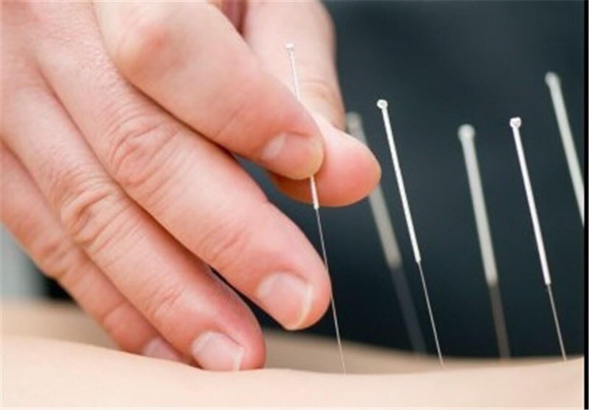 طب سوزنی دیابت را درمان می‌کند؟