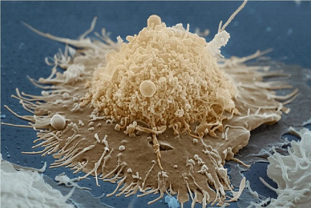 ابداع هوش مصنوعی تشخیص دهنده دیابت، اچ‌آی‌وی و کرونا از نمونه خون