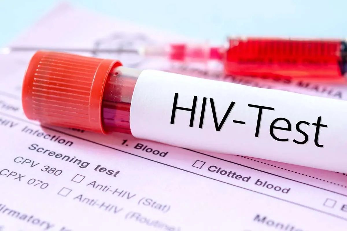 پیشرفت مهم در مسیر درمان «HIV» که پژوهشگران را شگفت‌زده کرد