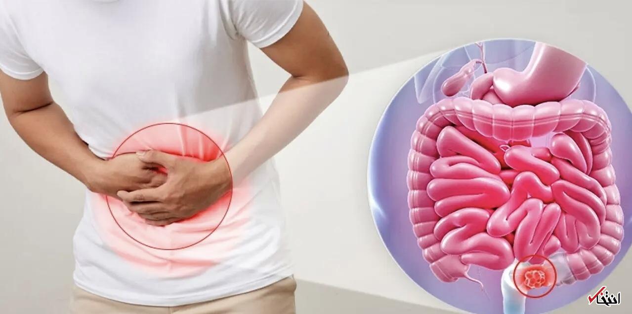 هفت عادت مخرب برای سلامت روده